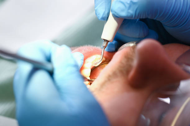 Best Cosmetic Emergency Dentistry in Chillum, MD