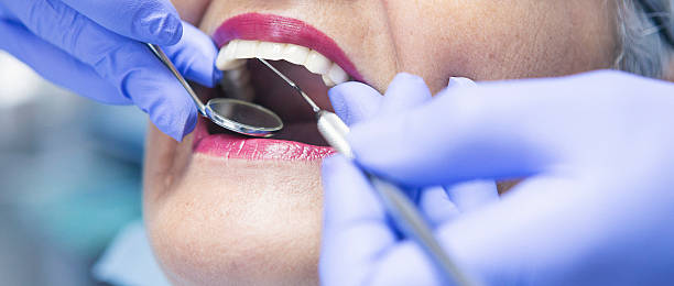Best Emergency Tooth Extraction in Chillum, MD